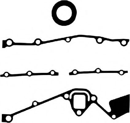 комплект гарнитури, ангренажен корпус